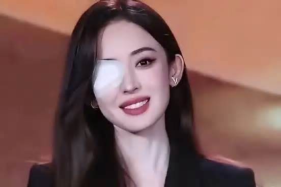 34岁古力娜扎回应病情：情况不太妙，未来可能要动手术